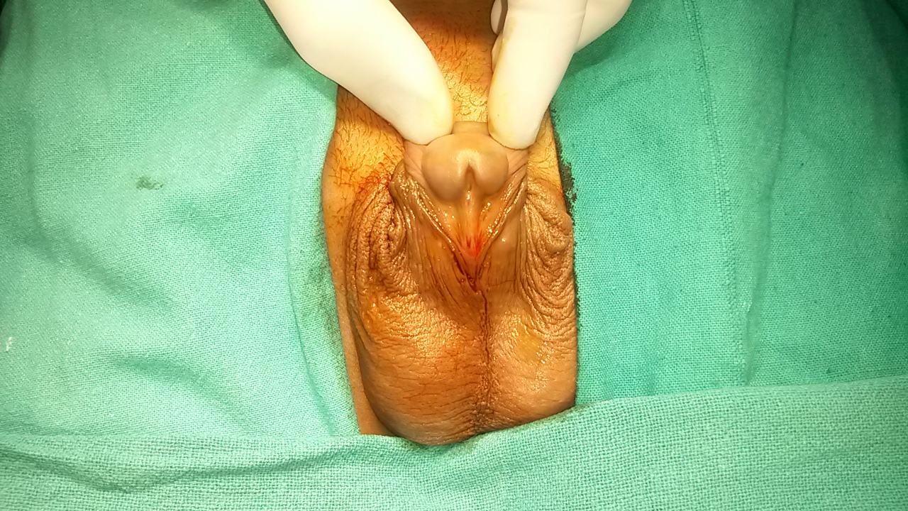 Pediatric Urology Image 4
